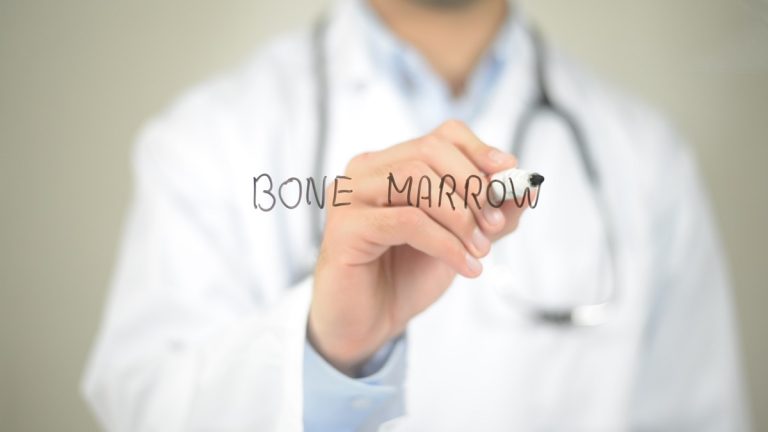 How Long Does it Take to Recover from Bone Marrow Donation?